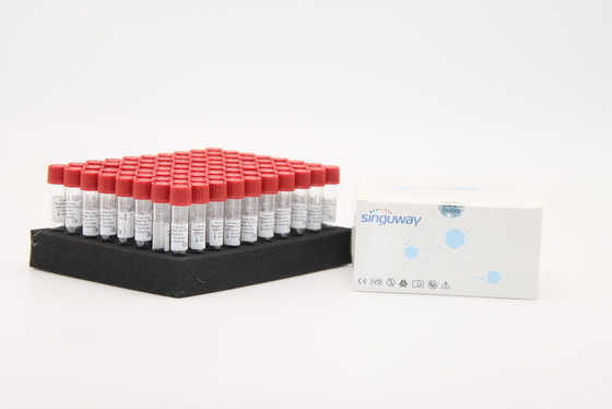 Singuwaypcr van de het Virussteekproef van de Testgriep van de de Versiereagens de Uitrusting van de RNAextractie