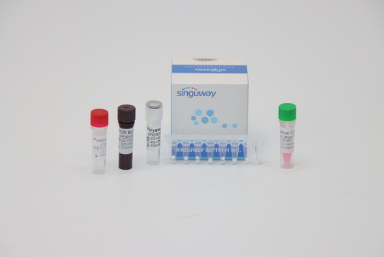 HPV 16 18 Virus nucleïnezuur Zuur die rechts-PCR Testuitrusting ISO13485 testen
