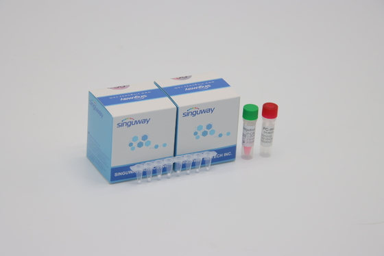 HIV Virus Kwantitatief fluorescerend PCR Ce In echte tijd van de Opsporingsuitrusting POCT