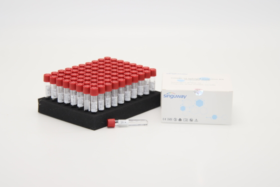 Hoogst Gevoelige 80 Tests 1 PCR van de Extractiekit for van het Stap nucleïnezuur Zuur