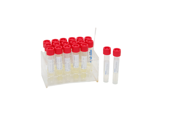 2mL de beschikbare Reageerbuis van Kit Medical VTM van de Virusbemonstering met de Stok van de Keelzwabber