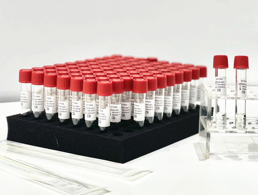 Één PCR van de de Versiereagens van de Stapsteekproef Extractie Kit From Patient Pharynx Swab
